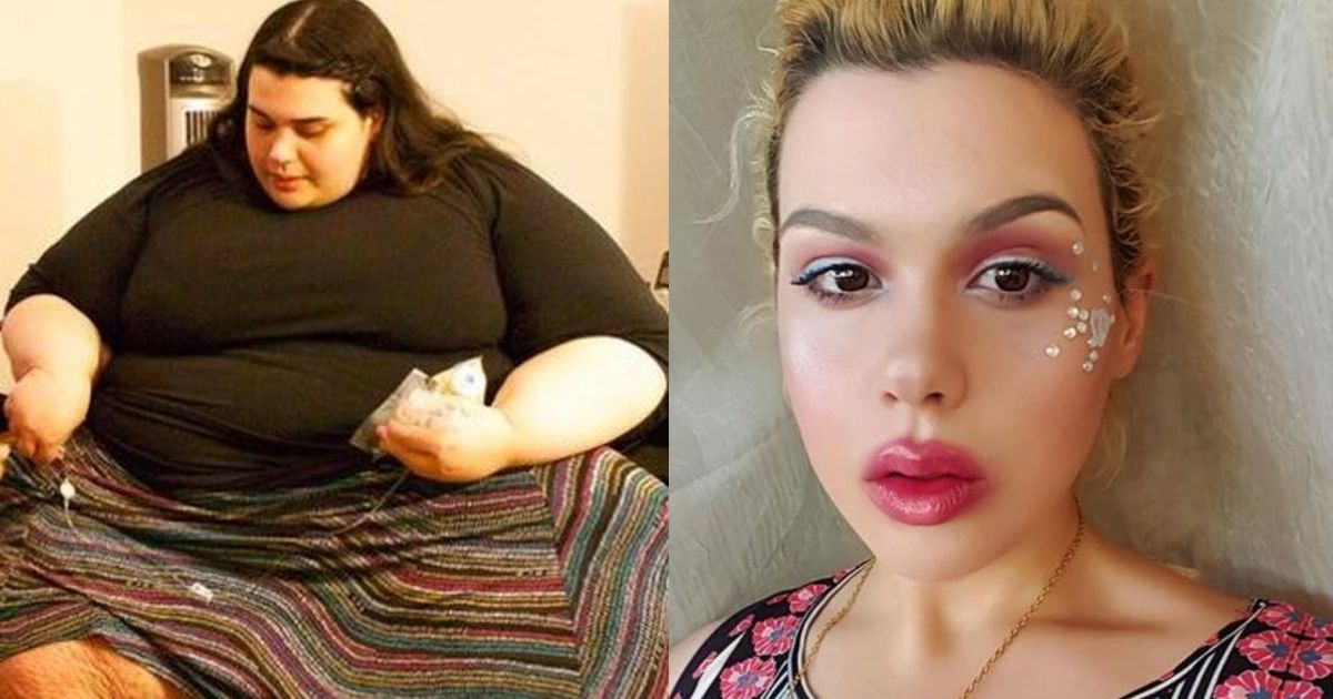 Watch The Amazing Journey of a 657 LB Woman Who Lost An Astonishing 400 Lbs...